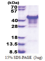 Carbonic anhydrase 14 (16-290, His-tag) Human Protein