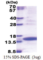 TIMM8A (1-97, His-tag) Human Protein
