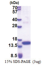 Tyrosine-protein kinase JAK2 (1014-1132, His-tag) Human Protein