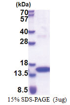 Tyrosine-protein kinase JAK2 (1014-1132, His-tag) Human Protein