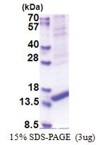 ARMS2 (1-107, His-tag) Human Protein