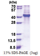 Lumican (19-338, His-tag) Human Protein