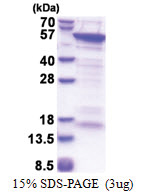 CUEDC1 (1-386, His-tag) Human Protein