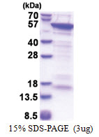 CUEDC1 (1-386, His-tag) Human Protein