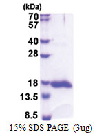 Galectin-13 (1-139, His-tag) Human Protein