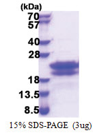 CEND1 (1-125, His-tag) Human Protein