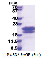 CEND1 (1-125, His-tag) Human Protein