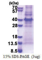 MLF1IP (147-418, His-tag) Human Protein