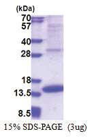 MIA (25-131, His-tag) Human Protein