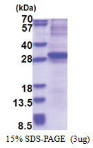 Neurogenin-3 / NEUROG3 (1-214, His-tag) Human Protein