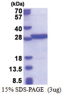 PABPN1 (119-306, His-tag) Human Protein