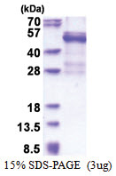 Cathepsin W (22-376, His-tag) Human Protein