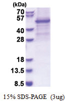 GSK3 beta (1-420) Human Protein