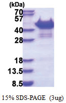 SORBS3 / SCAM1 (1-329, His-tag) Human Protein
