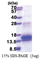 WFDC12 / WAP2 (24-111, His-tag) Human Protein