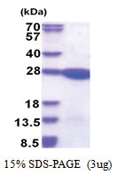 LZIC (1-190, His-tag) Human Protein