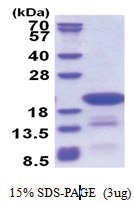 C14orf126 (1-168, His-tag) Human Protein