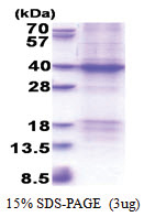 XRCC2 (1-280, His-tag) Human Protein