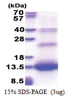 Resistin (19-108, His-tag) Human Protein