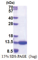 CKS1B (1-79, His-tag) Human Protein