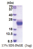 CHAC2 (1-184, His-tag) Human Protein
