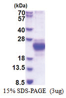 CHAC2 (1-184, His-tag) Human Protein