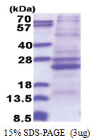 ATP5F1 (83-256, His-tag) Human Protein