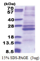 ATP5F1 (83-256, His-tag) Human Protein