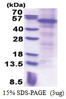 PARK2 / Parkin (1-465, His-tag) Human Protein