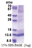 RAMP1 (27-117, His-tag) Human Protein