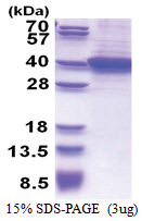 RLBP1 (1-317, His-tag) Human Protein