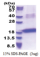 Chondromodulin-1 (214-334, His-tag) Human Protein