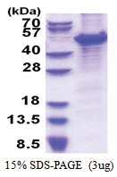 MCM7 (1-414, His-tag) Human Protein
