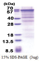 CD105 / Endoglin (26-586, His-tag) Human Protein