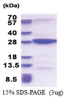 MOBKL2B (1-216, His-tag) Human Protein