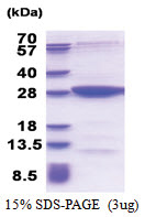 MOBKL2B (1-216, His-tag) Human Protein