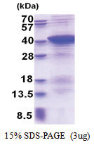 PDLIM1 (1-329, His-tag) Human Protein