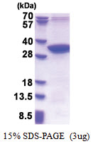 MMADHC (39-296, His-tag) Human Protein