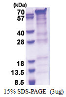 PRRT2 (1-268, His-tag) Human Protein