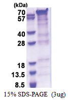 PRRT2 (1-268, His-tag) Human Protein