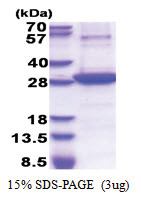 CD73 (27-252, His-tag) Human Protein