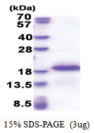 EAF1 (182-268, His-tag) Human Protein