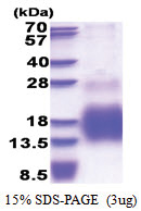 Metallothionein-3 (1-68, His-tag) Human Protein