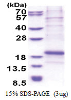 Chondromodulin-1 (214-333, His-tag) Human Protein