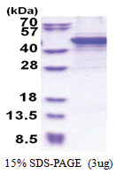 MMP-10 (99-476, His-tag) Human Protein