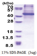 BCAR1 / CRKAS (465-848, His-tag) Human Protein