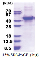MMP-13 (His-tag) Human Protein