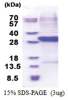 Complement factor B (26-259, His-tag) Human Protein