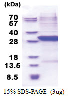 Complement factor B (26-259, His-tag) Human Protein