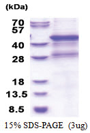 MMP-8 (His-tag) Human Protein
